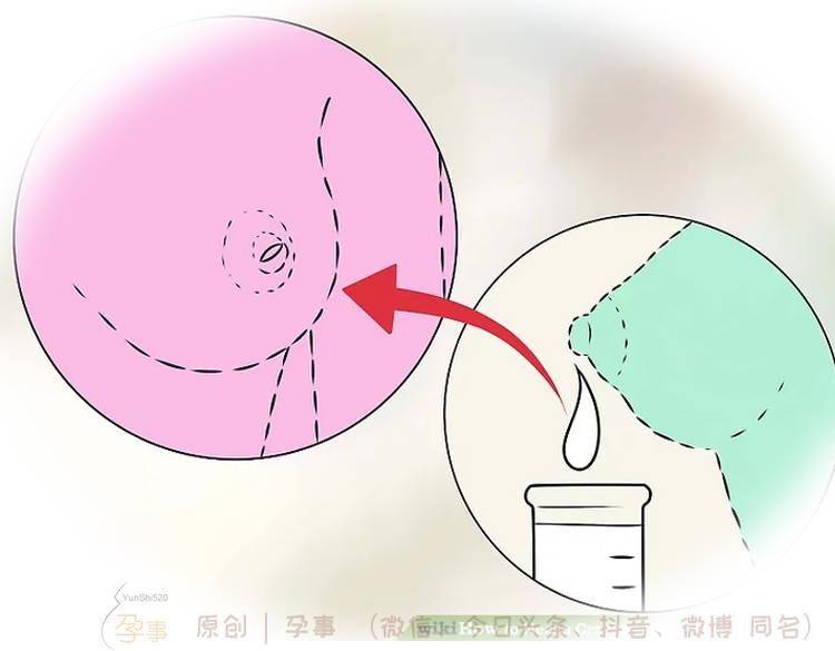 热依扎乳头皲裂疼到哭14个步骤做好护理少受罪