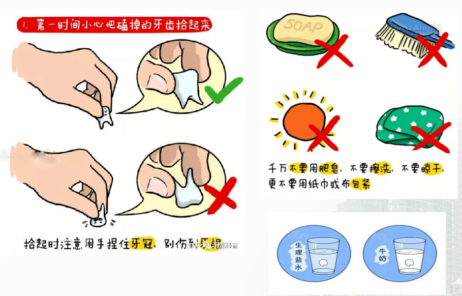 家长们看过来今晚730公益直播带你防治儿童牙外伤