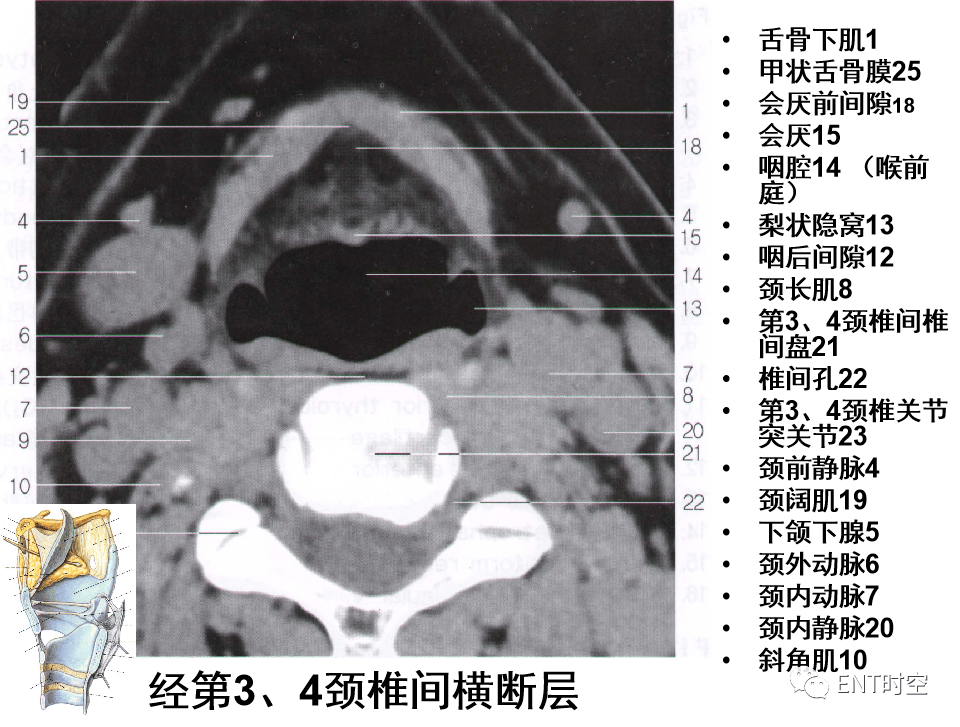 颈椎侧位x线片中易忽视的重要征象放射体检检查,最害怕这几件事发生做