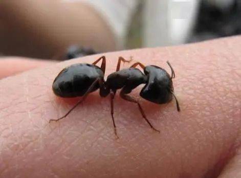 女子被蚂蚁咬了一口,竟休克昏迷!医生说:严重者或致死
