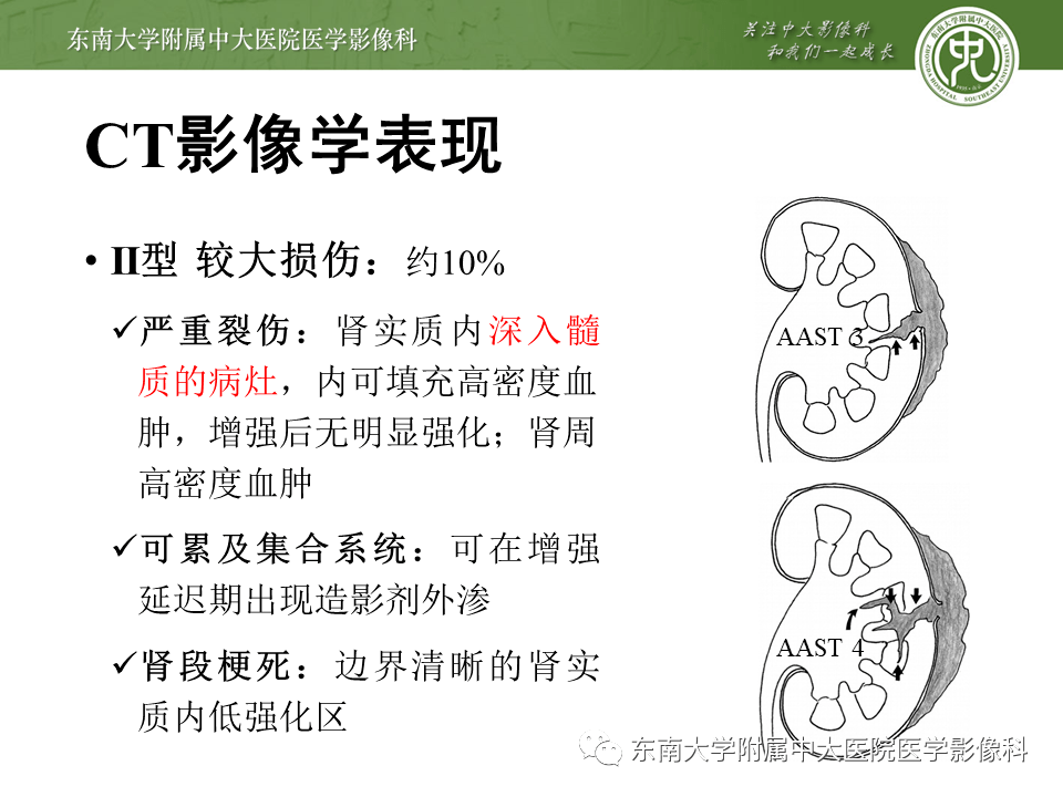 肾脏外伤影像学评估