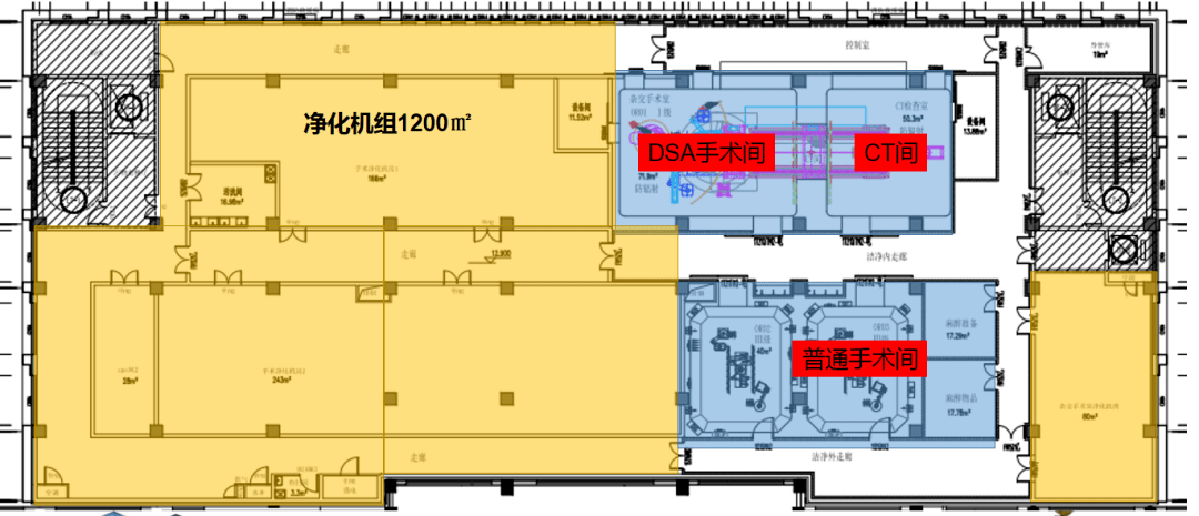 设置dsa ct杂交手术室一间,三级手术室两间和净化机组区四结合医院