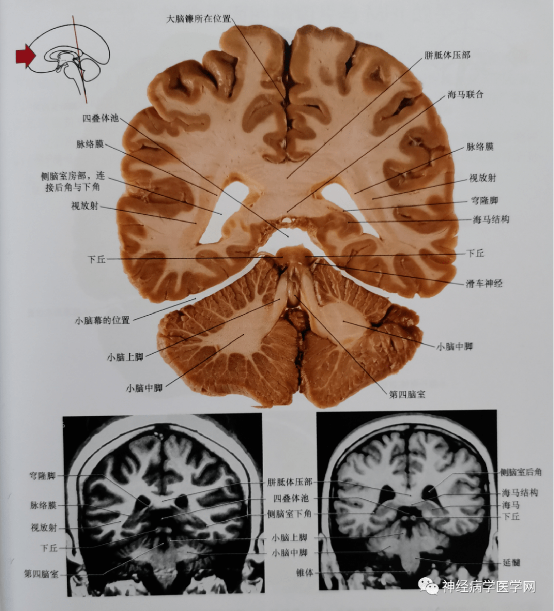临床神经解剖图谱(断层影像 切片)