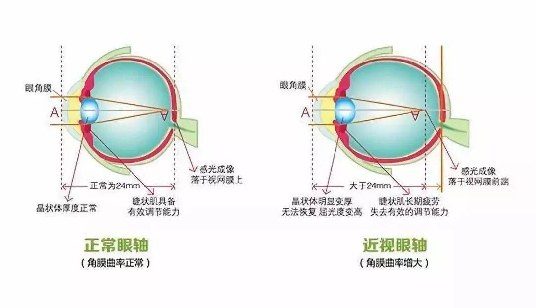 深入了解眼部结构和近视发生过程,科学防控!_眼睛
