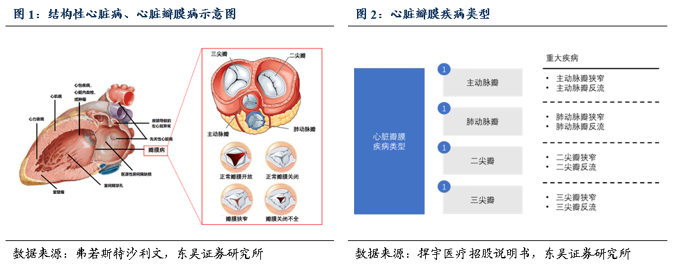 心脏瓣膜疾病 来自搜狐网
