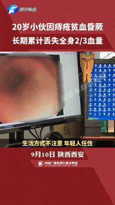 20岁小伙长痔疮竟失掉全身大半血量!这些不良生活习惯