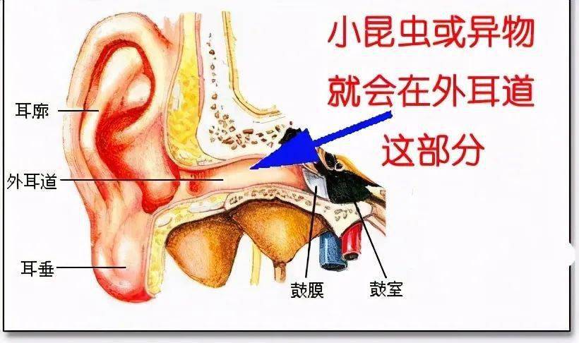 可能出现的并发症:外耳道炎,中耳炎,鼓膜穿孔等.
