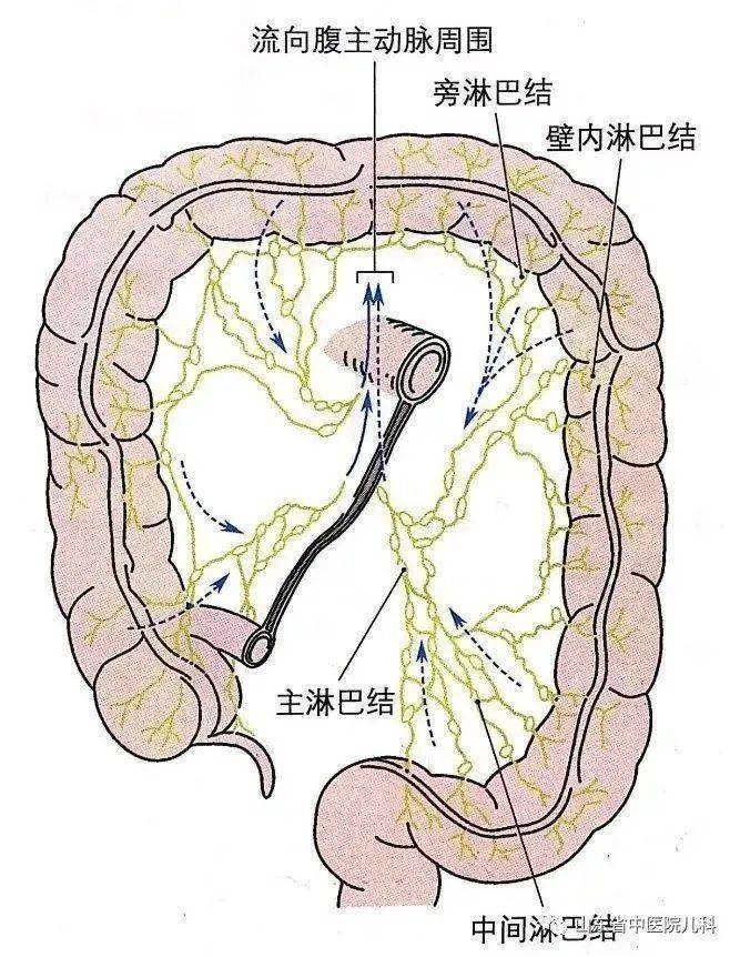 关于肠系膜淋巴结肿大须知道的几个问题