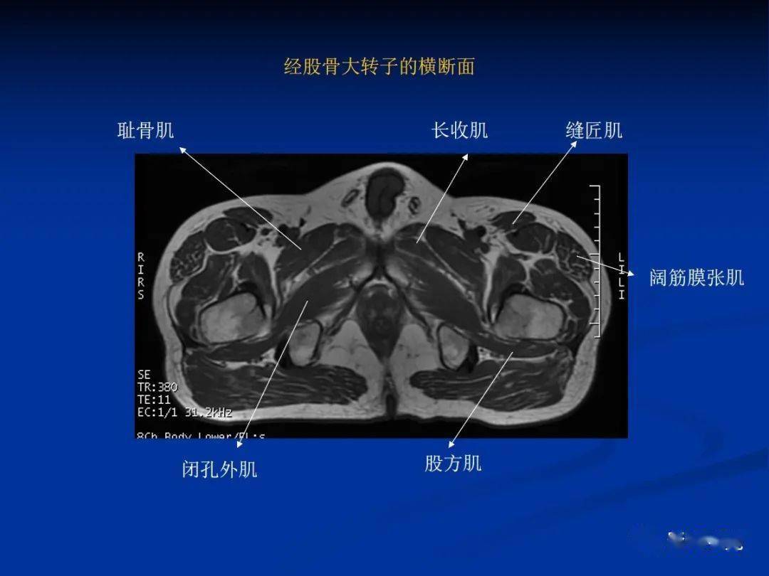 骨盆肌肉解剖_髋关节