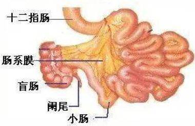 饭后剧烈运动饭后一动不动都能造成肠梗阻