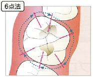 你真的掌握牙周袋探针深度了么