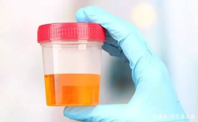 肝脏|肝功差的人，身体一般有5个表现，若没有，则肝脏还算健康