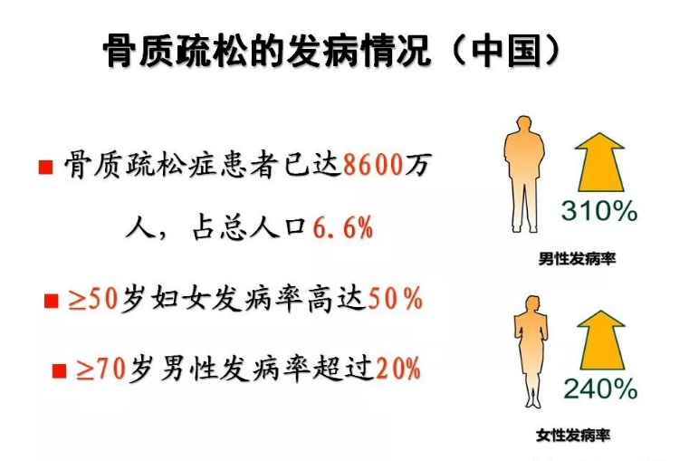 骨质疏松,你还以为只是老年人的"专利"吗?_骨骼_骨质疏松症_人群