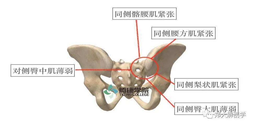 一侧的骶骼关节损伤造成感受器传入信号错误,可出现同侧骼腰肌,腰方肌