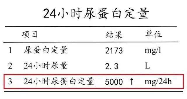 小南话科普24小时尿蛋白定量检测你需要知道的留样细节