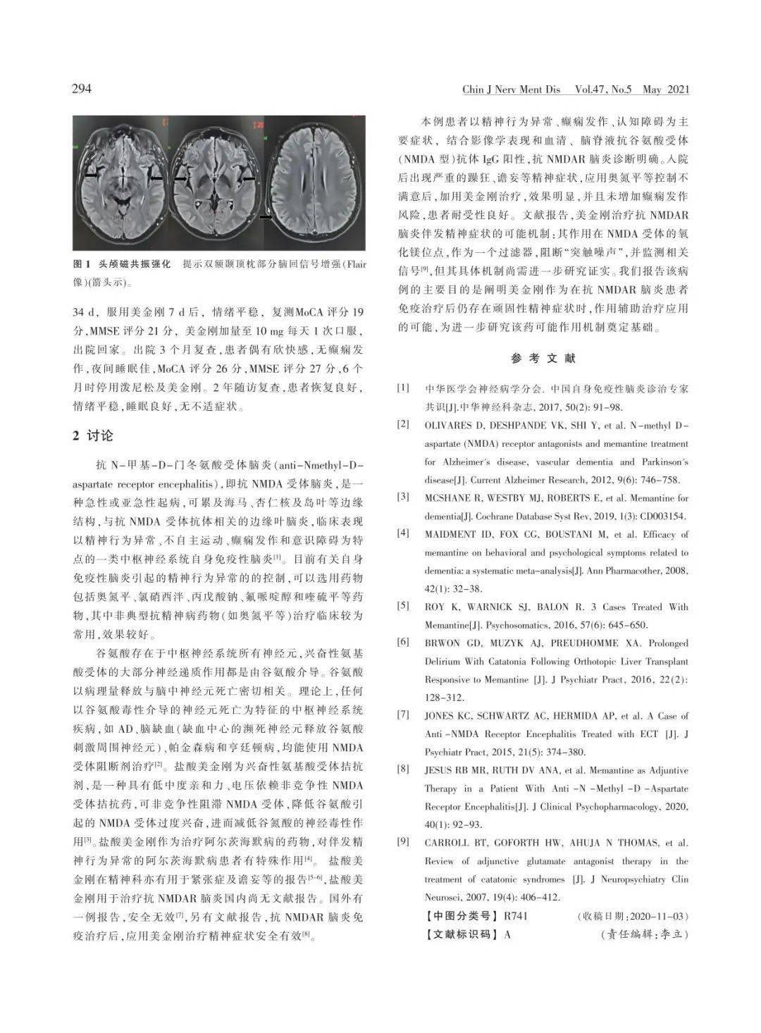 病例报告|美金刚联合奥氮平治疗伴发顽固精神症状抗nmdar脑炎1例_论著