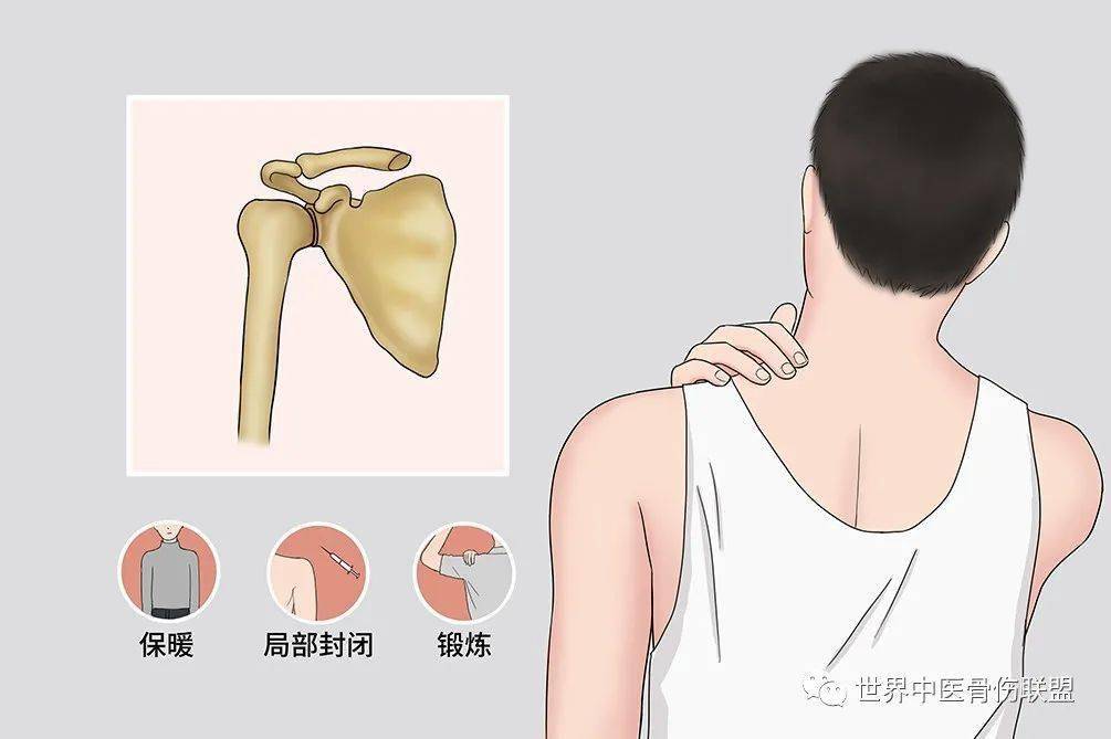 肩关节痛_进行_治疗_症状