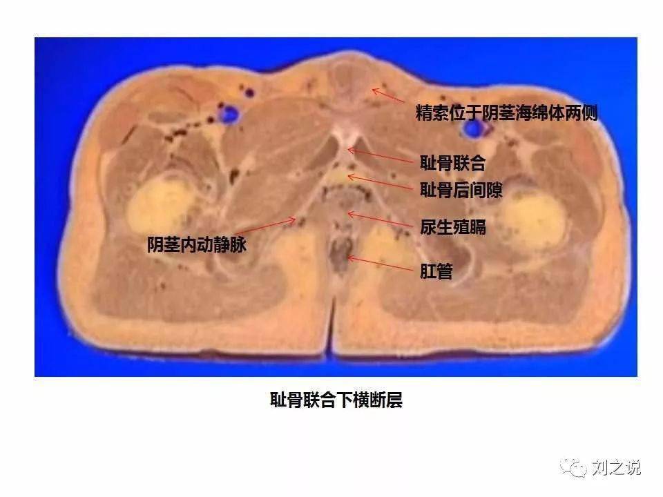 收藏必备男性盆腔断层解剖