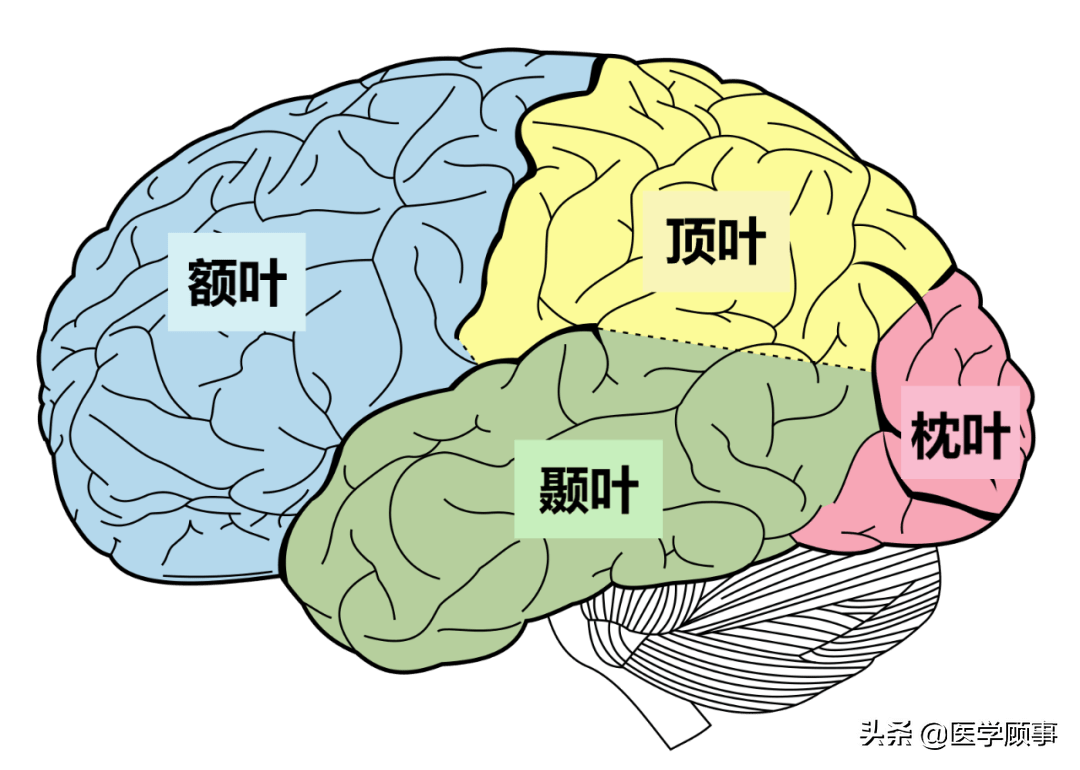 大脑部分缺失功能竟无损伤读了研还精通两门语言