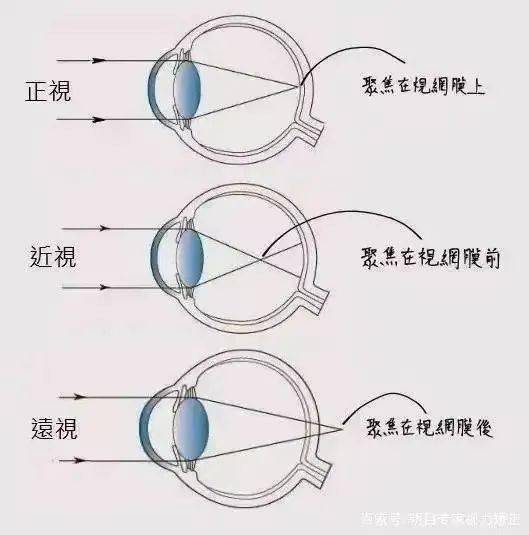 眼科▏为什么一定要测眼轴