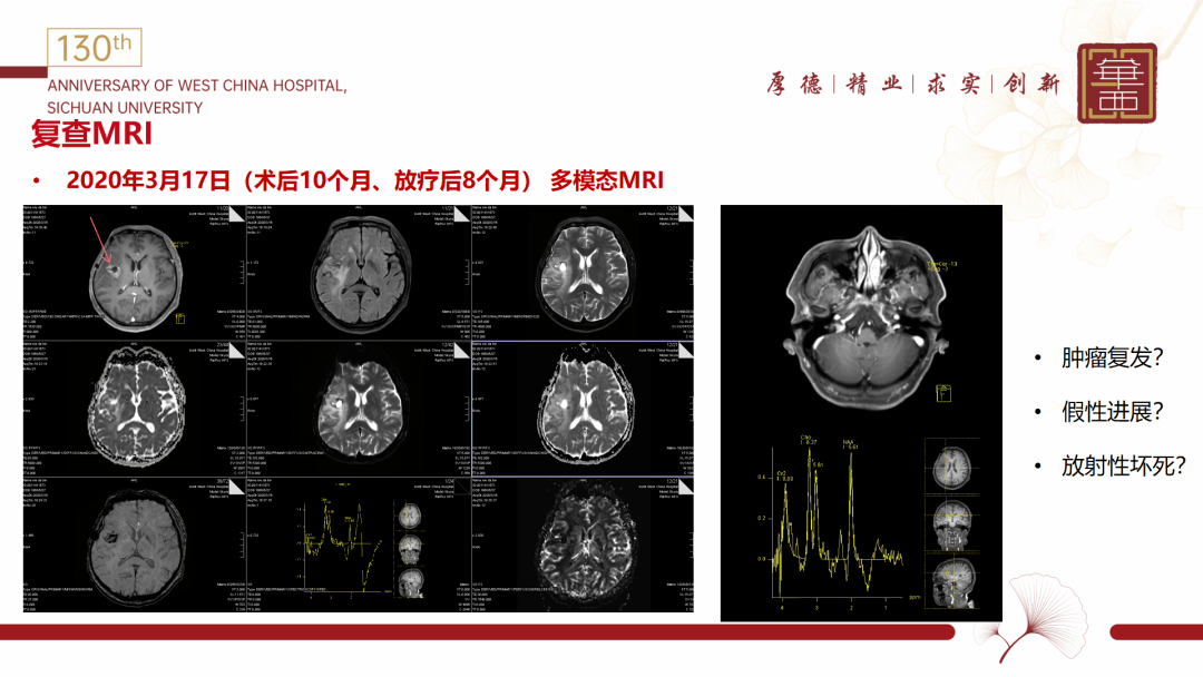 王茂德教授