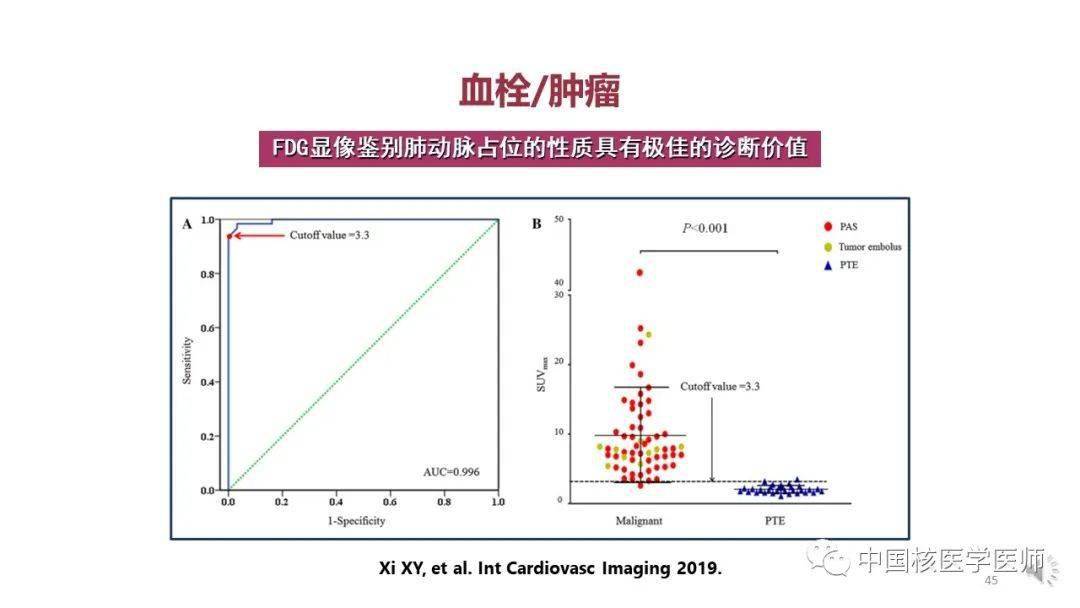 【核汇园】67期:杨敏福教授 fdg心血管显像的拓