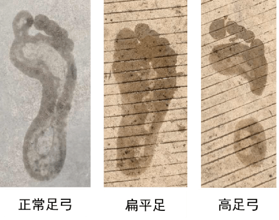 最大的不同之处在于稳定支撑型跑鞋在鞋内侧足弓最高处往往有硬质材料