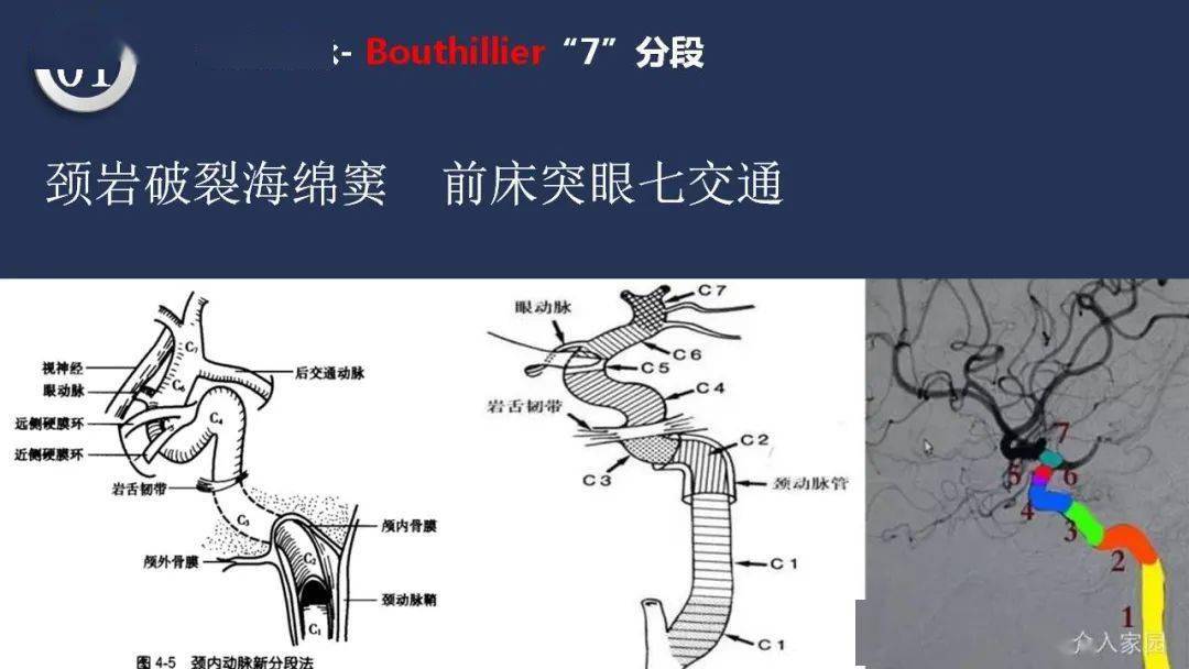 高清头颈动脉系统解剖,保你过目不忘_神经_梅斯_交流