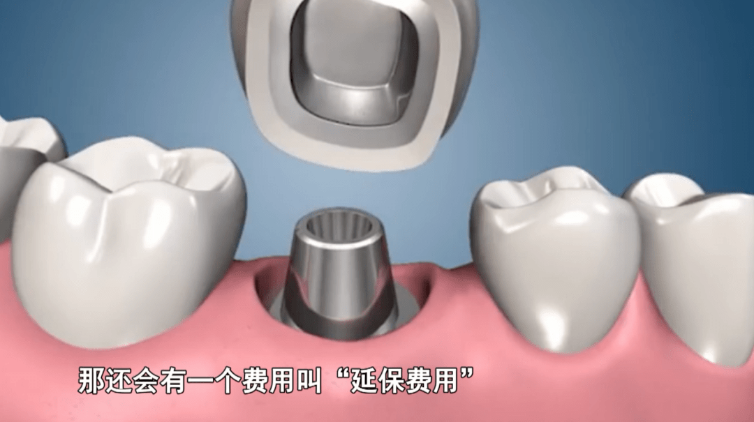 抖音号交易兔牙网是真的吗吗可信吗