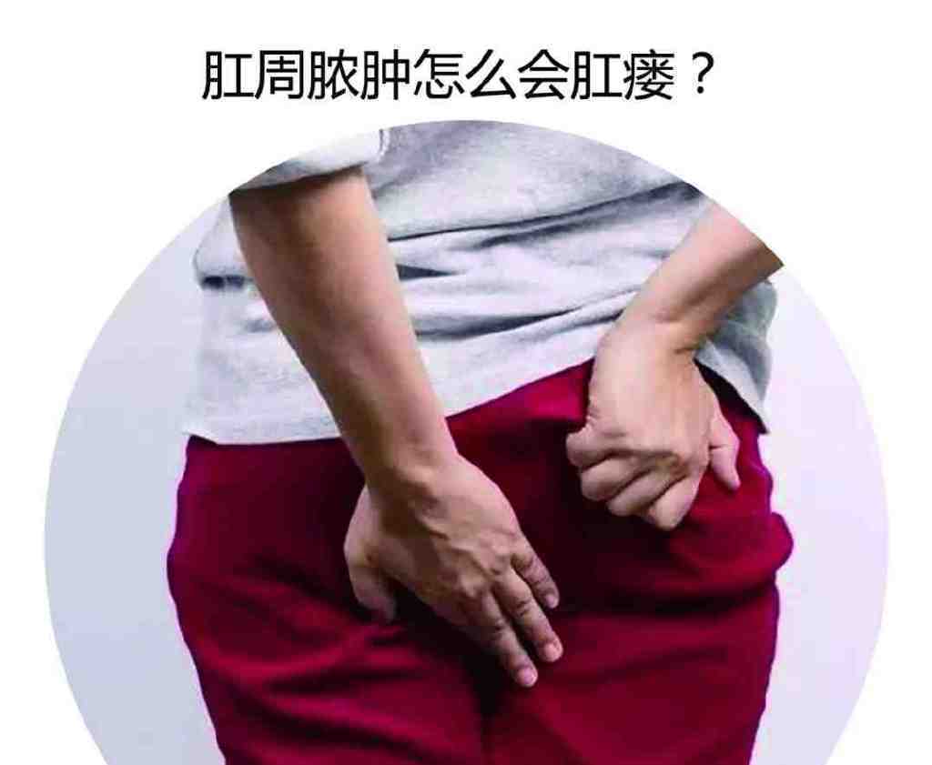 小迈课堂|肛肠疾病四大金刚之一—肛周脓肿_肛门