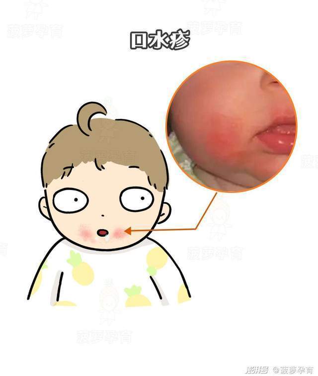 成都助孕哪家好（宝宝流口水的危害，你知道吗？）