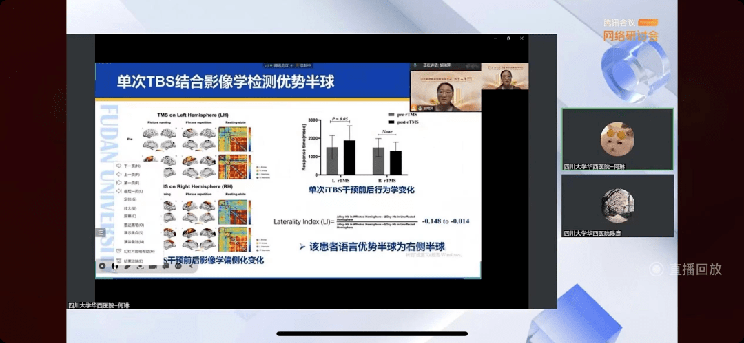 胡瑞萍教授详细全方位介绍了神经调控技术在失语症中的临床应用.