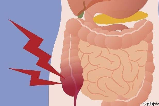 原创 你对急性阑尾炎了解多少?半分钟带你了解急性阑尾炎