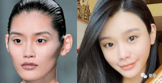 除开太阳穴的部分,还有一个就是后区,这个部分包括颞线,颞骨以及顶骨