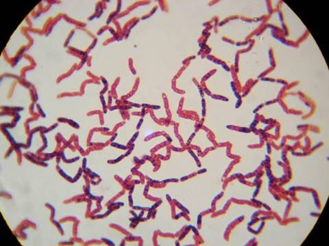 微生物能降解土壤中的农药残留是真的吗进来看看