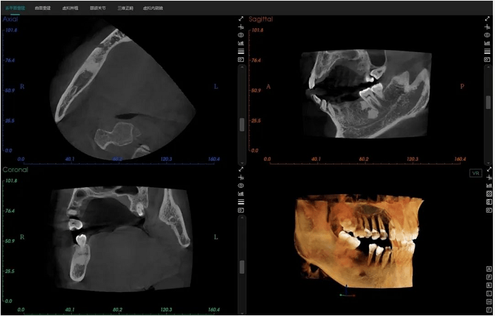 这台有"ai"的口腔cbct来了!