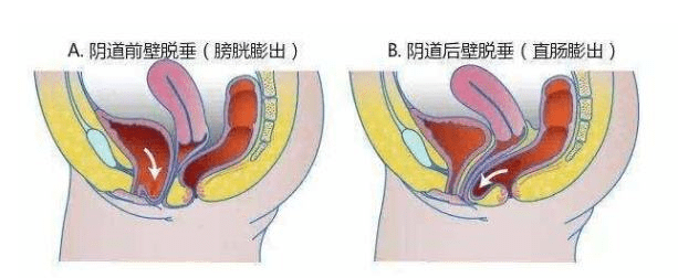 一边保持纸片人身材一边备孕可太难了!