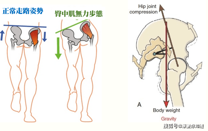 不明原因腰痛可能是骶髂關節失能