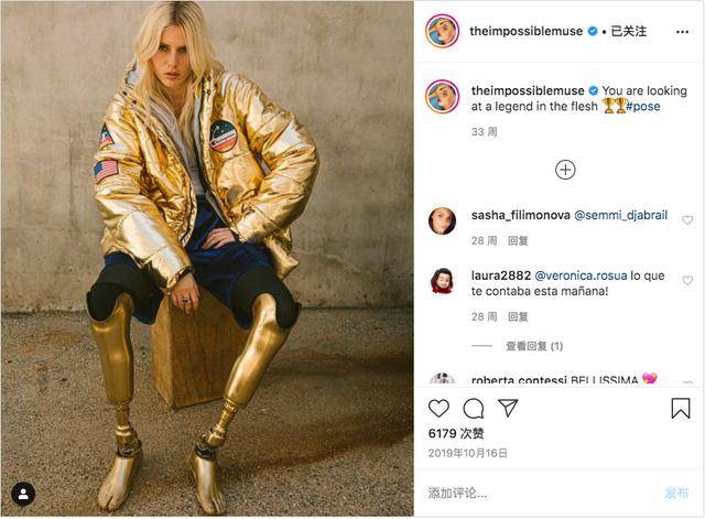 伤健女模lauren wasser装义肢华丽逆袭