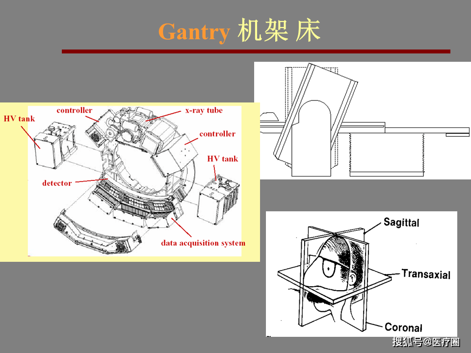 CT设备构成详解(多图)_http
