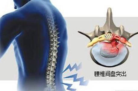 铁腰板治疗仪是真的吗17年品牌保证_资讯_中国财经网