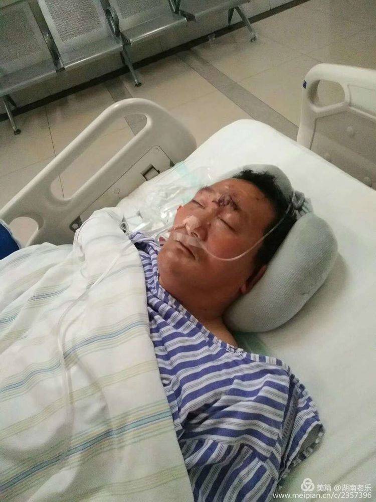 叶廷的父亲叶宏军躺在医院治疗