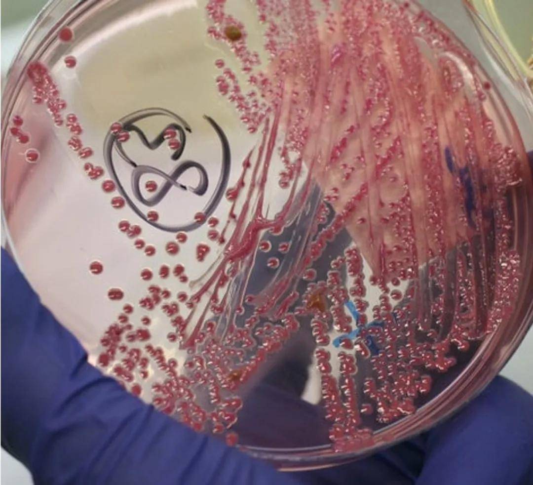 伦敦大学的研究人员设计了一种在环境照明下便能发挥作用的抗菌涂层