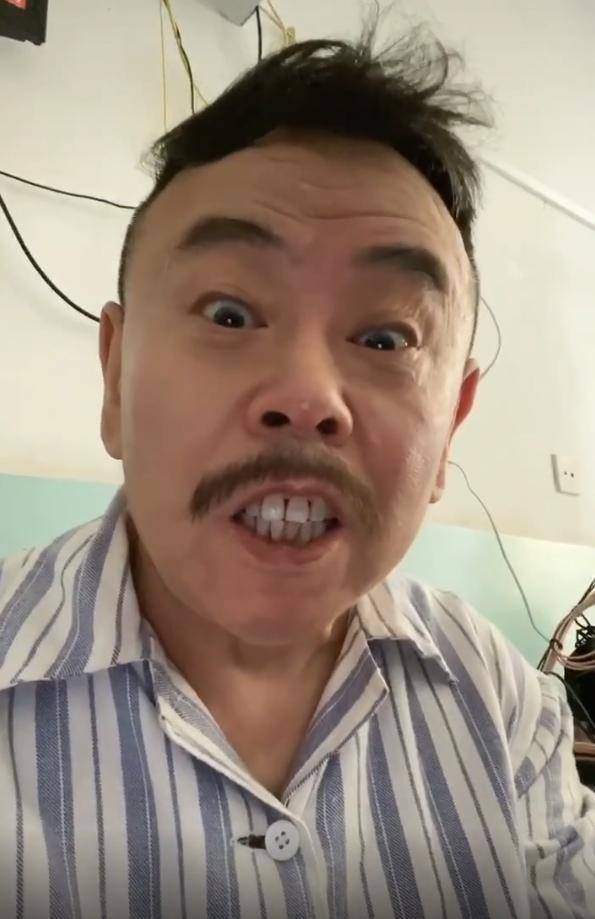 63岁潘长江头发乱糟糟地穿病号服却自嘲开心就好惹粉丝心疼