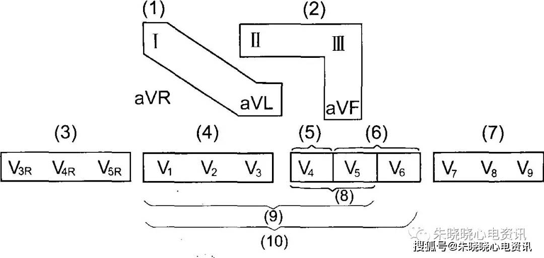 心梗心电图定位九宫格图片