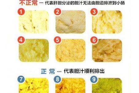 宝宝拉屎有奶瓣是怎么回事为什么会有这种情况