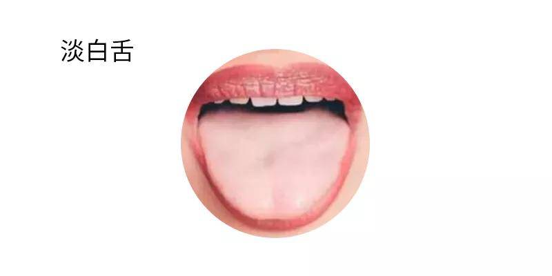 5种常见舌相学起来,出现第四种需要及时就医!_舌头