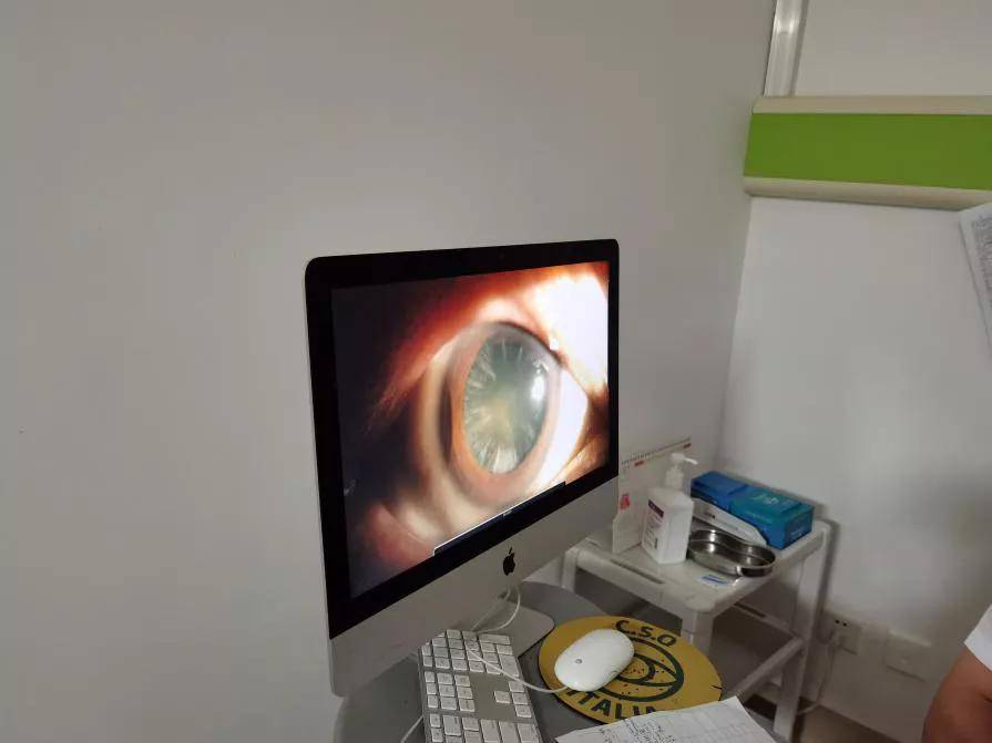 福建爱尔康三焦点人工晶体成功植入,大叔术后视力重返年轻态