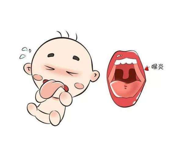 今日讲谈家长怎么判断小儿咽喉炎在家咋个带娃