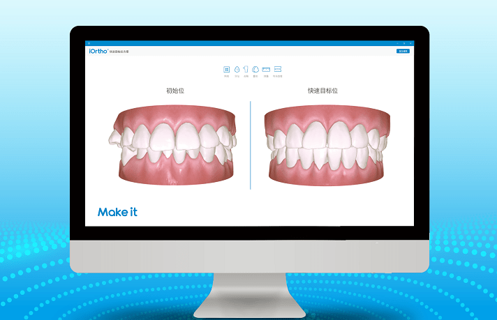 效果|襄阳3D全新数字化口扫，颠覆传统取模方式，欢迎前来体验！
